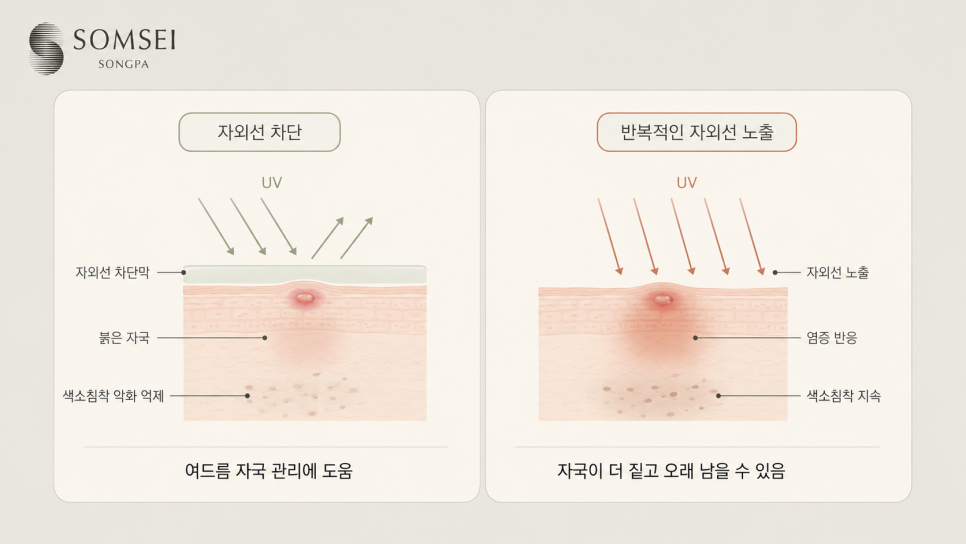 자외선은 이미 생긴 자국을 더 오래 남게 합니다.