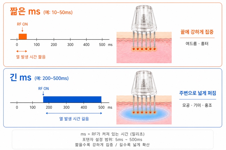 같은 팁이라도 시간을 짧게 주면 표면, 길게 주면 깊은 층에 남습니다.