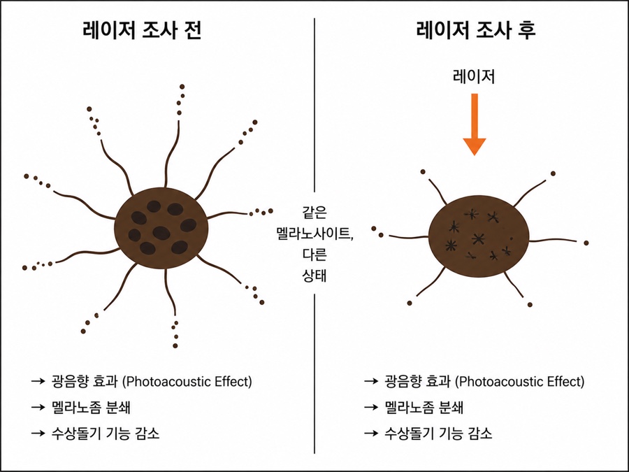 세게 조사하면 공장이 자극을 받아 더 만들어 냅니다.