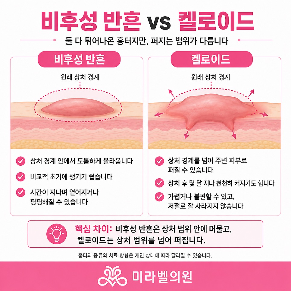 붉게 튀어나온 흉터, 저절로 없어지나요? (약수역 흉터치료)