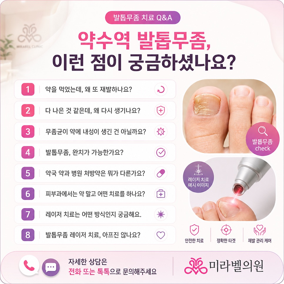 진료실에서 자주 받는 발톱무좀 관련 질문