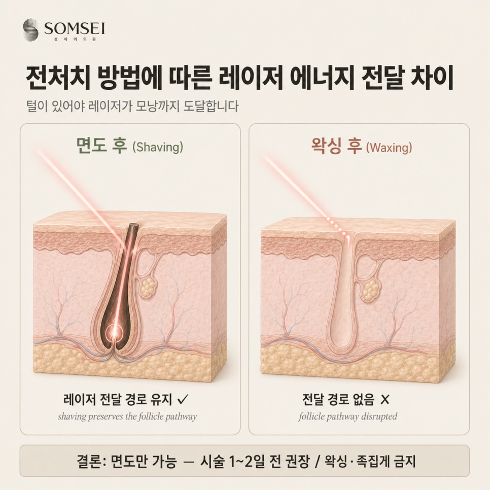 전처치 방법에 따른 레이저 에너지 전달 차이