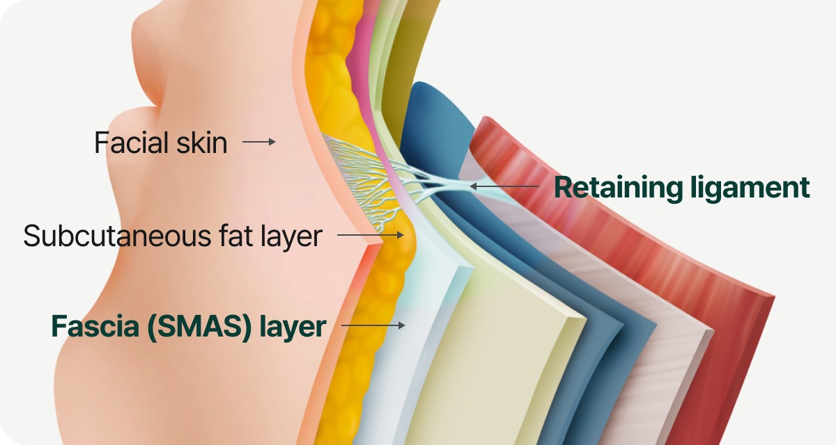 얼굴은 한 덩어리가 아니라 여러 층으로 이루어져 있습니다. 특히 SMAS(fascia layer)와 retaining ligament는 얼굴 구조를 받쳐주는 핵심 지지층입니다