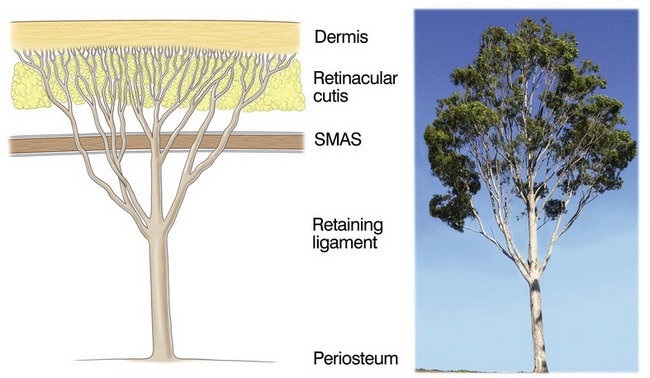 SMAS 가 지지층 (갈색 두꺼운 선), retaining ligament 가 인대 역할 (나뭇가지 모양)