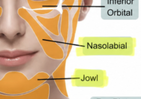 볼살이 있으면 인상을 무겁게 만드는 부위