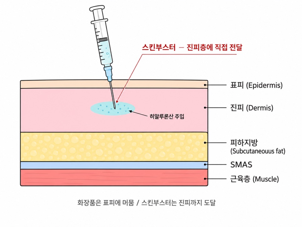 같은 히알루론산인데 왜 다른가요 (강동구 스킨부스터)