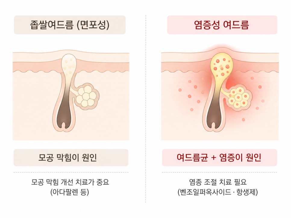 만 9세 이상: 에피듀오겔을 써봅니다