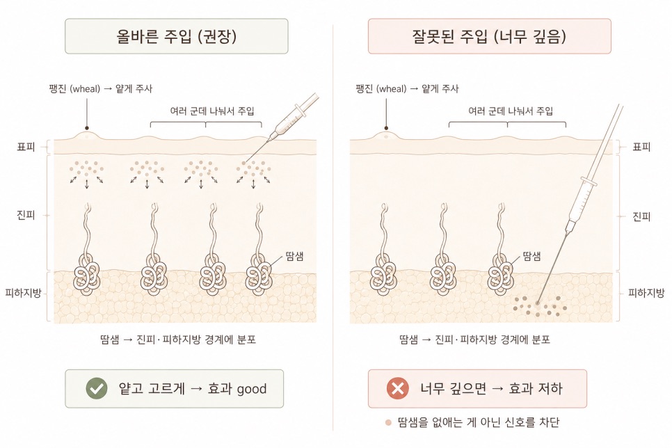 주사 깊이에 따른 차이