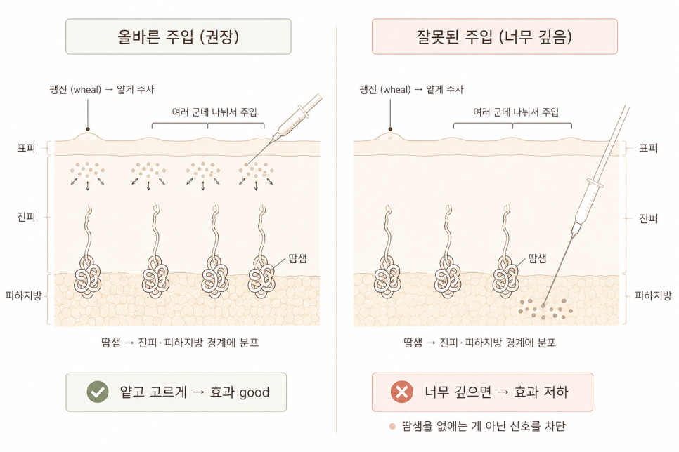 주사 깊이에 따른 차이