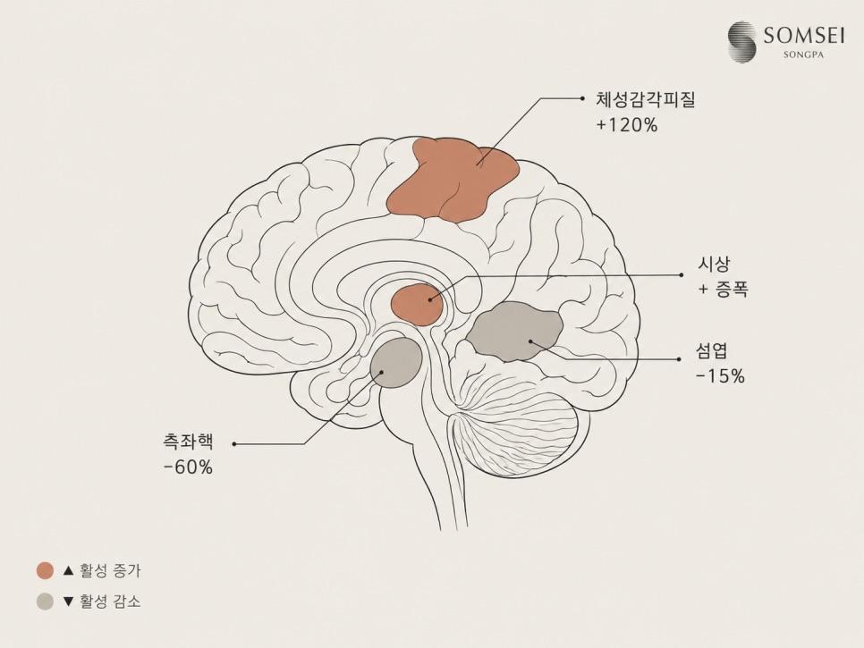 통증은 피부가 아니라 뇌에서 완성됩니다