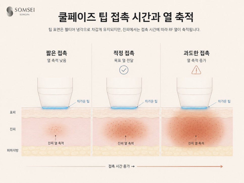 팁이 차가워도 오래 대고 있으면 안되는 이유
