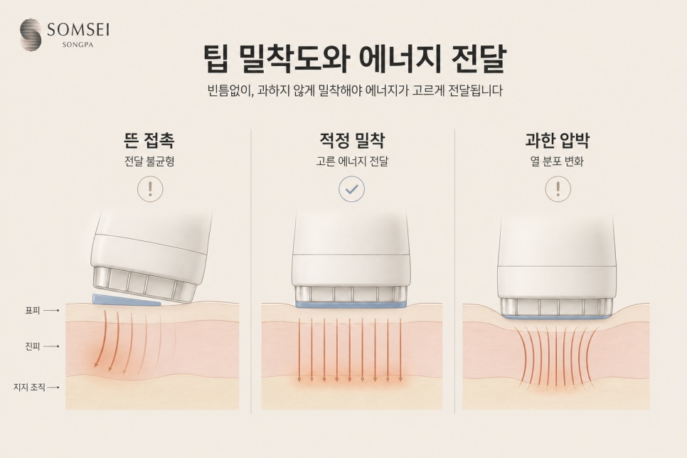 팁을 어떻게 대느냐입니다