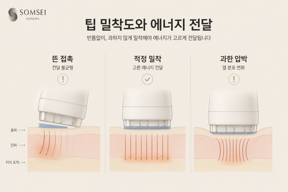 팁을 어떻게 대느냐입니다